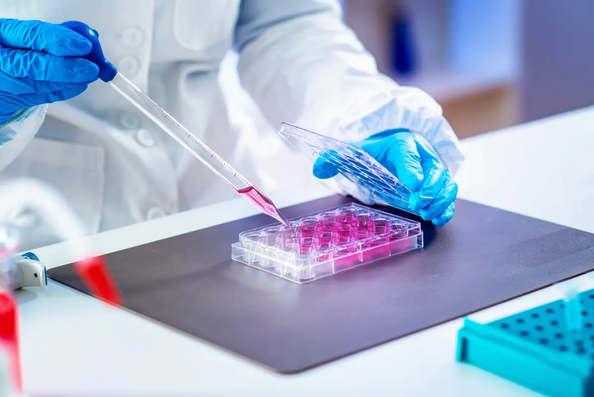 Benefits of Stem Cell Therapy for Arthritis