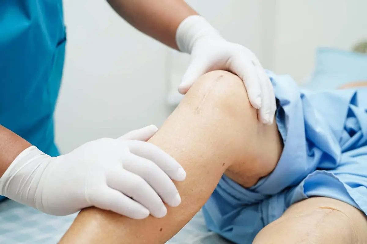 Knee Replacement and Weight Management: Impact on Long-Term Results