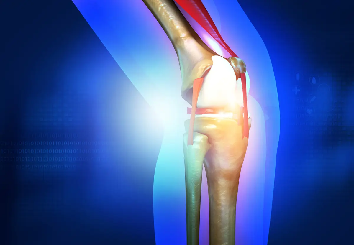 Why Do Some Patients Experience More Pain After a Knee Replacement Than Others?
